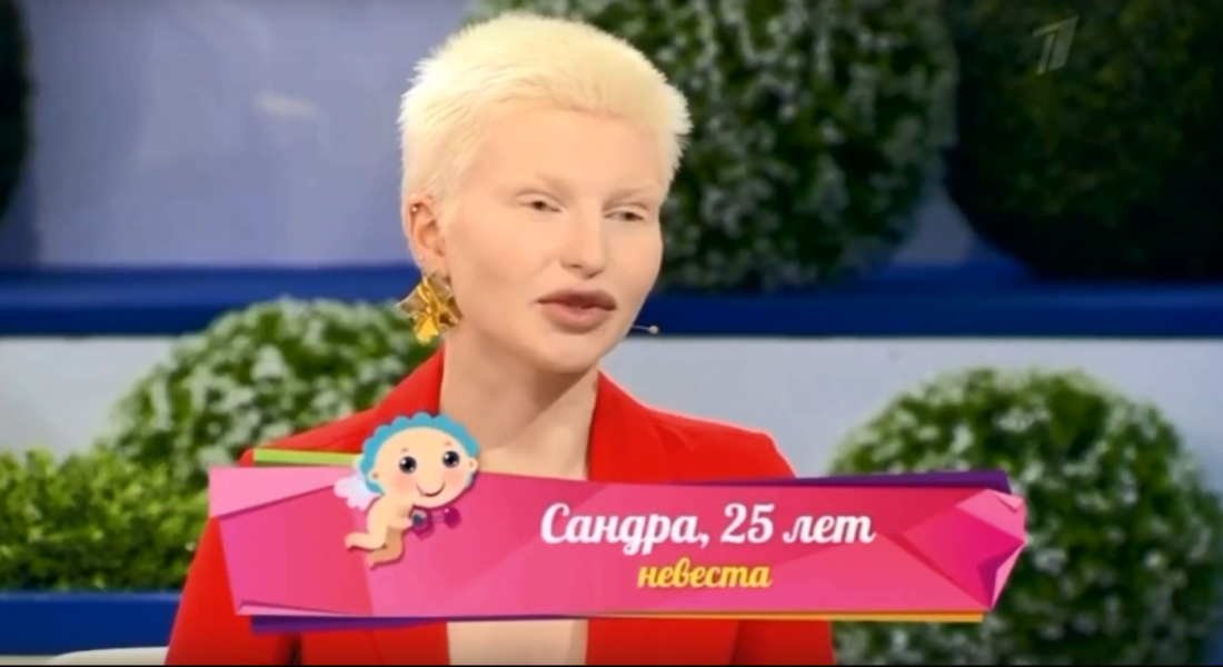 Модель из Мурманска рассказала о сложной судьбе Ларисе Гузеевой на Первом канале Сандра Капшук